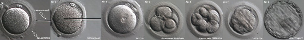 https://malinov-clinic.com/wp-content/uploads/2022/07/embrioni.in_.vitro_.malinov.jpg