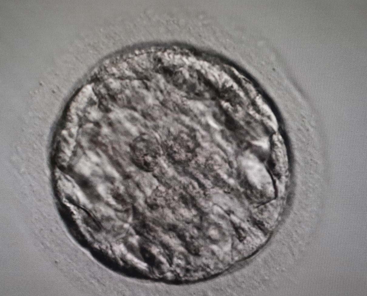 https://malinov-clinic.com/wp-content/uploads/2022/07/malinov.embrion.jpg